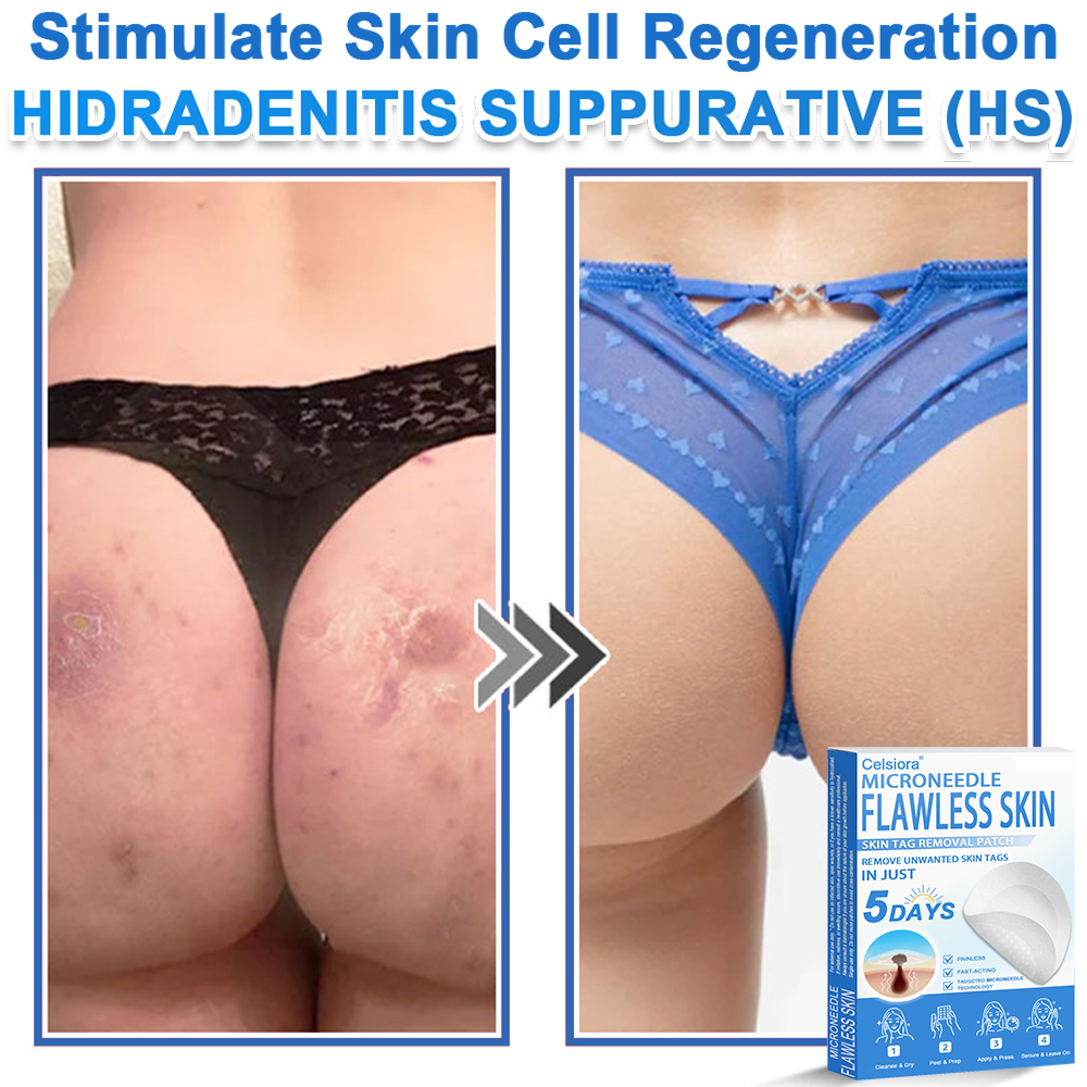 🔥 Celsiora® 2-in-1 Microneedle & Hydrocolloid Patch | Raised Moles,Acne,  Flat Warts & Skin Tags Remover | Improves Wrinkles, Scars & Blemishes | Invisible Pimple Patches for Face & Body