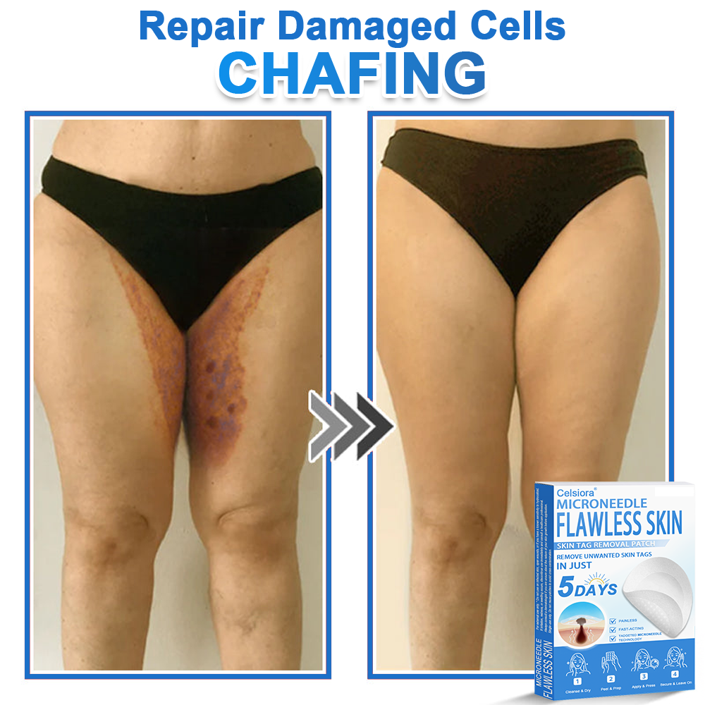 🔥 Celsiora® 2-in-1 Microneedle & Hydrocolloid Patch | Raised Moles,Acne,  Flat Warts & Skin Tags Remover | Improves Wrinkles, Scars & Blemishes | Invisible Pimple Patches for Face & Body