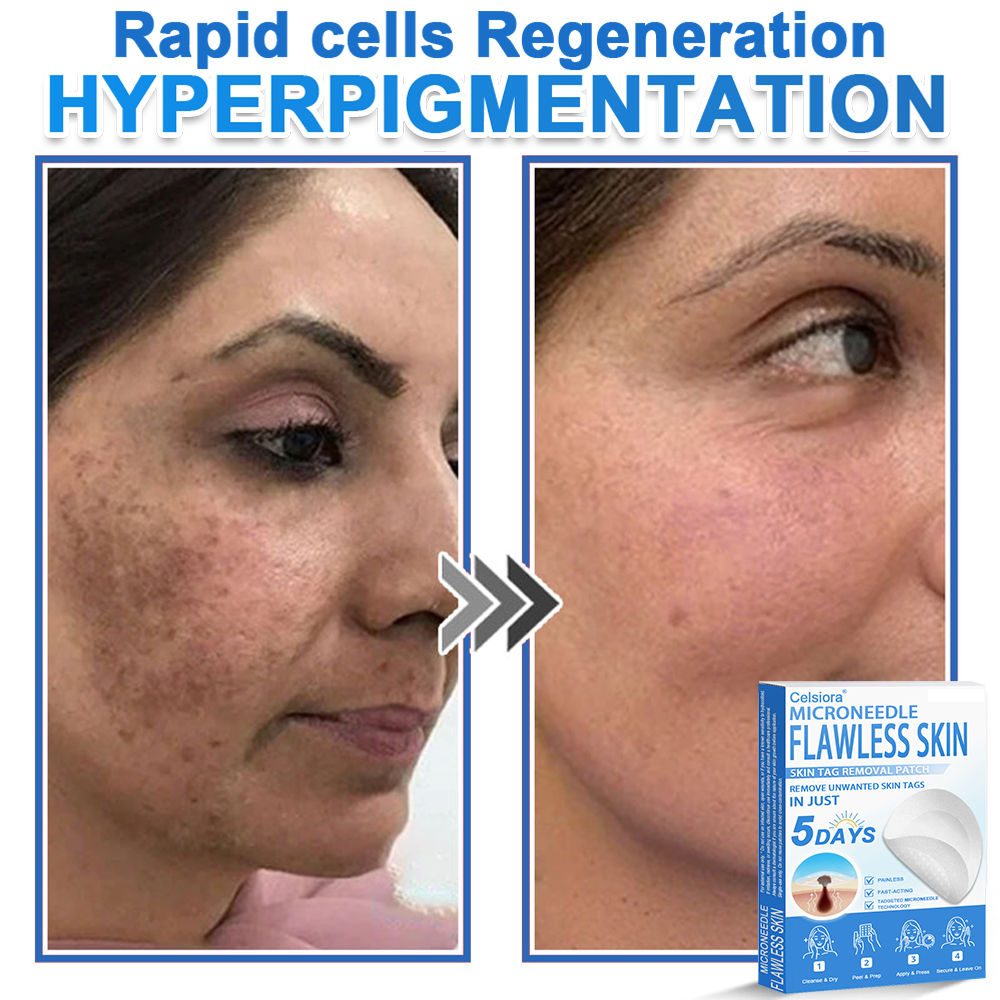 🔥 Celsiora® 2-in-1 Microneedle & Hydrocolloid Patch | Raised Moles,Acne,  Flat Warts & Skin Tags Remover | Improves Wrinkles, Scars & Blemishes | Invisible Pimple Patches for Face & Body
