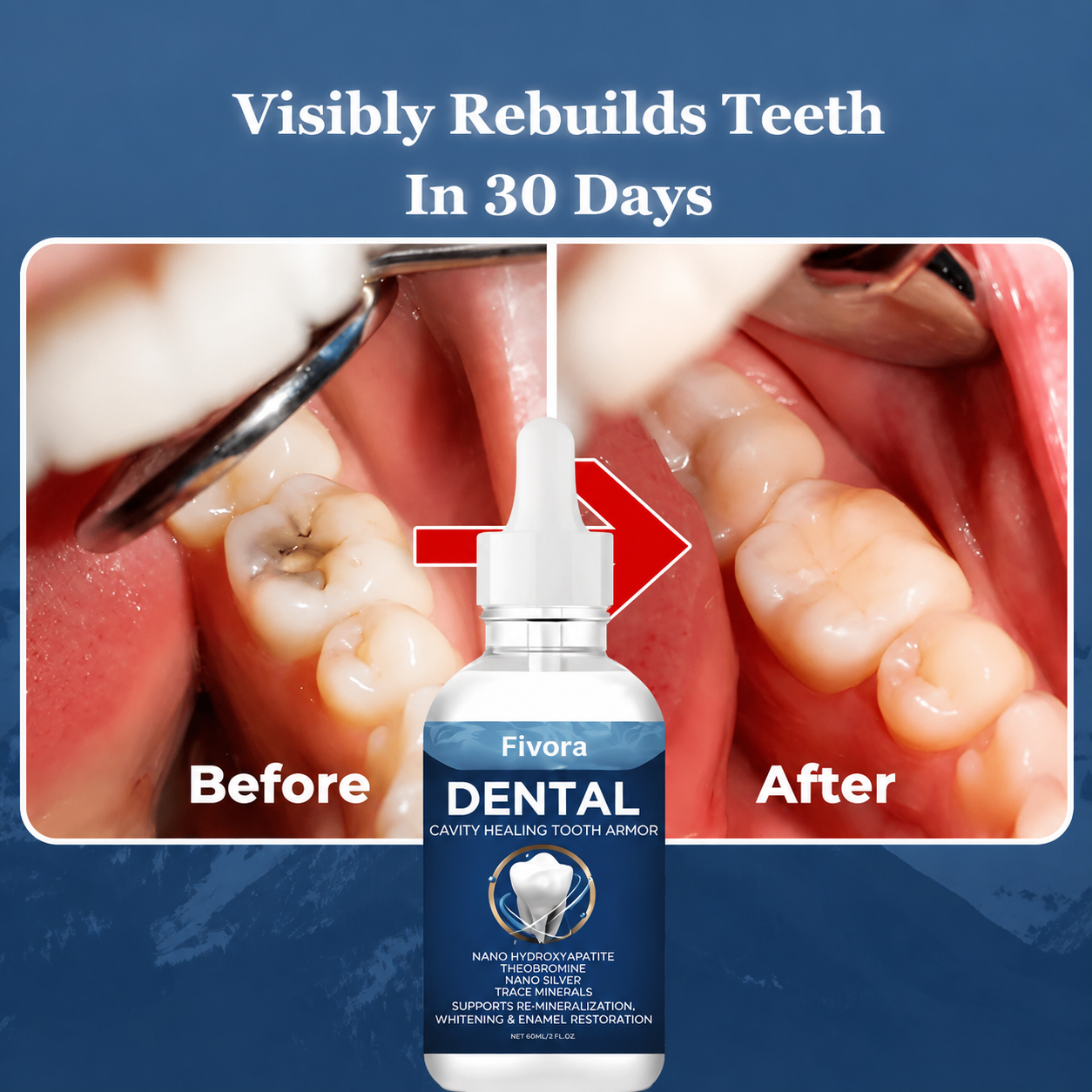 Fivora™ Advanced Enamel Repair & Whitening Kit (Includes Free LED Mirror)