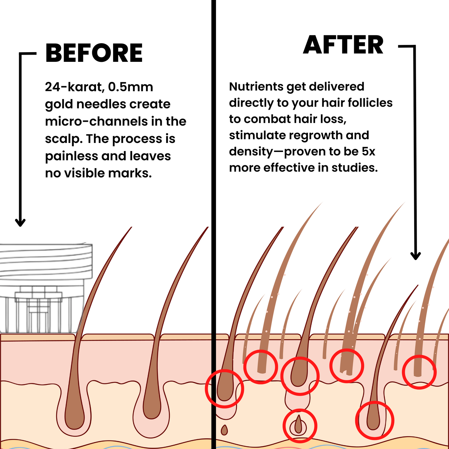 Fivora™ Hair Regrowth System