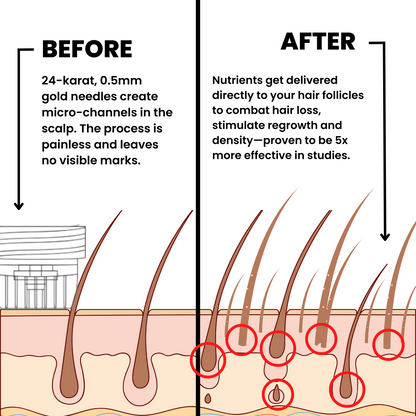 Fivora™ Hair Regrowth System